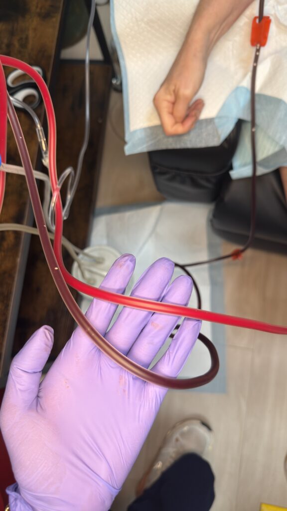 EBOO Therapy